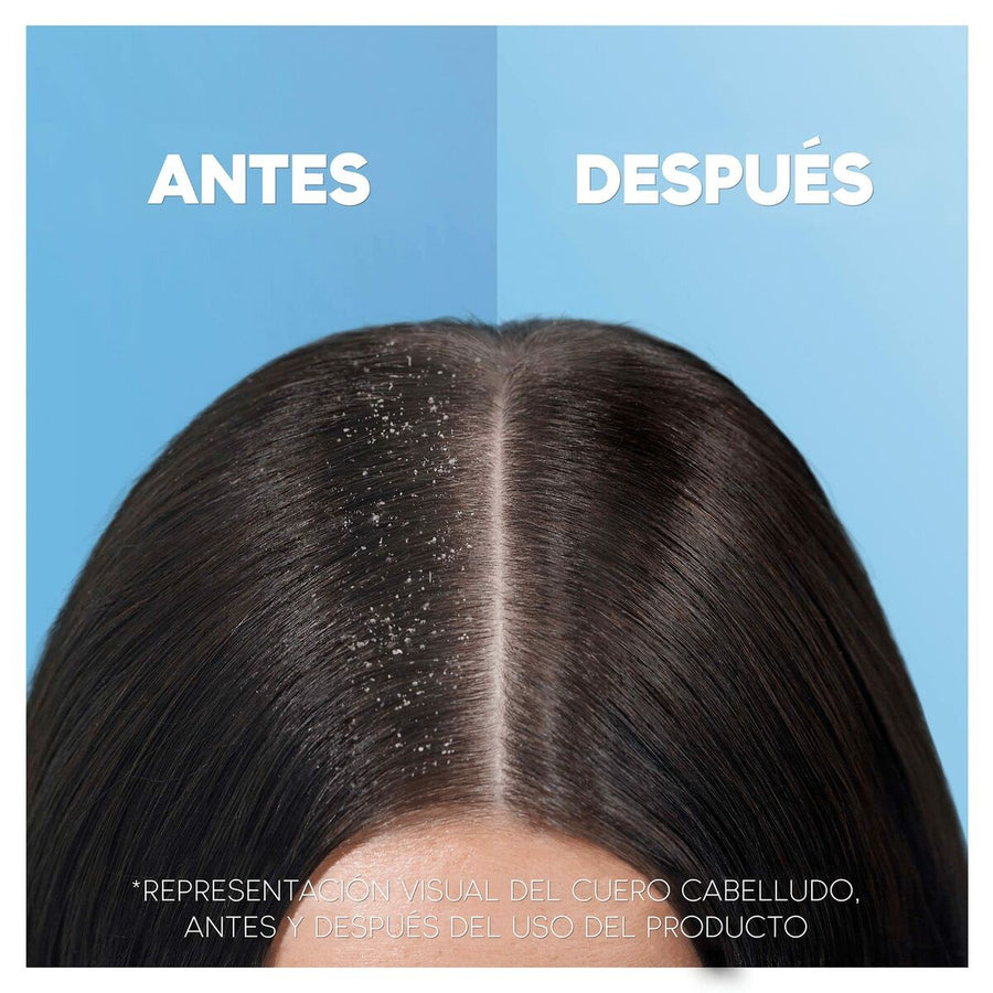 Champô Head & Shoulders H&S Refreshing Menthol 1 L